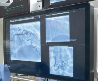 Terapia guiada por imágenes Instituto Cardiovascular Rosario