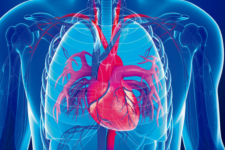 Ateneo de Cardiología - Puesta al día - Rol del ECMO en distintos escenarios