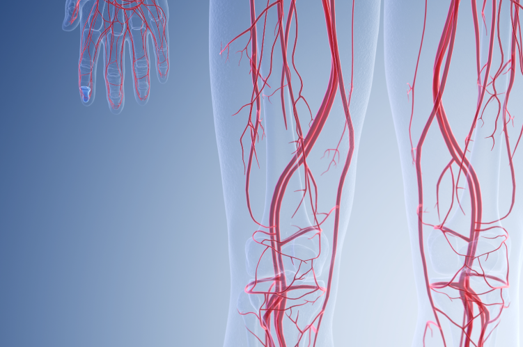 Ateneo Central Online | Puesta al día | ARTERIOPATÍA PERIFÉRICA: Lo que debe saber el Cardiólogo Clínico