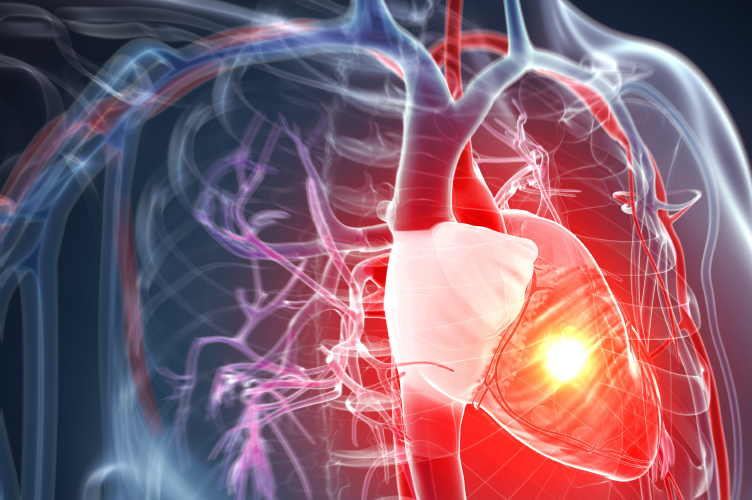 Ateneo Central Online | Shock Cardiogénico postoperatorio. El uso de Swan-Ganz y ECMO.