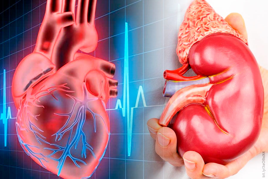 Disfunción renal en el infarto agudo de miocardio